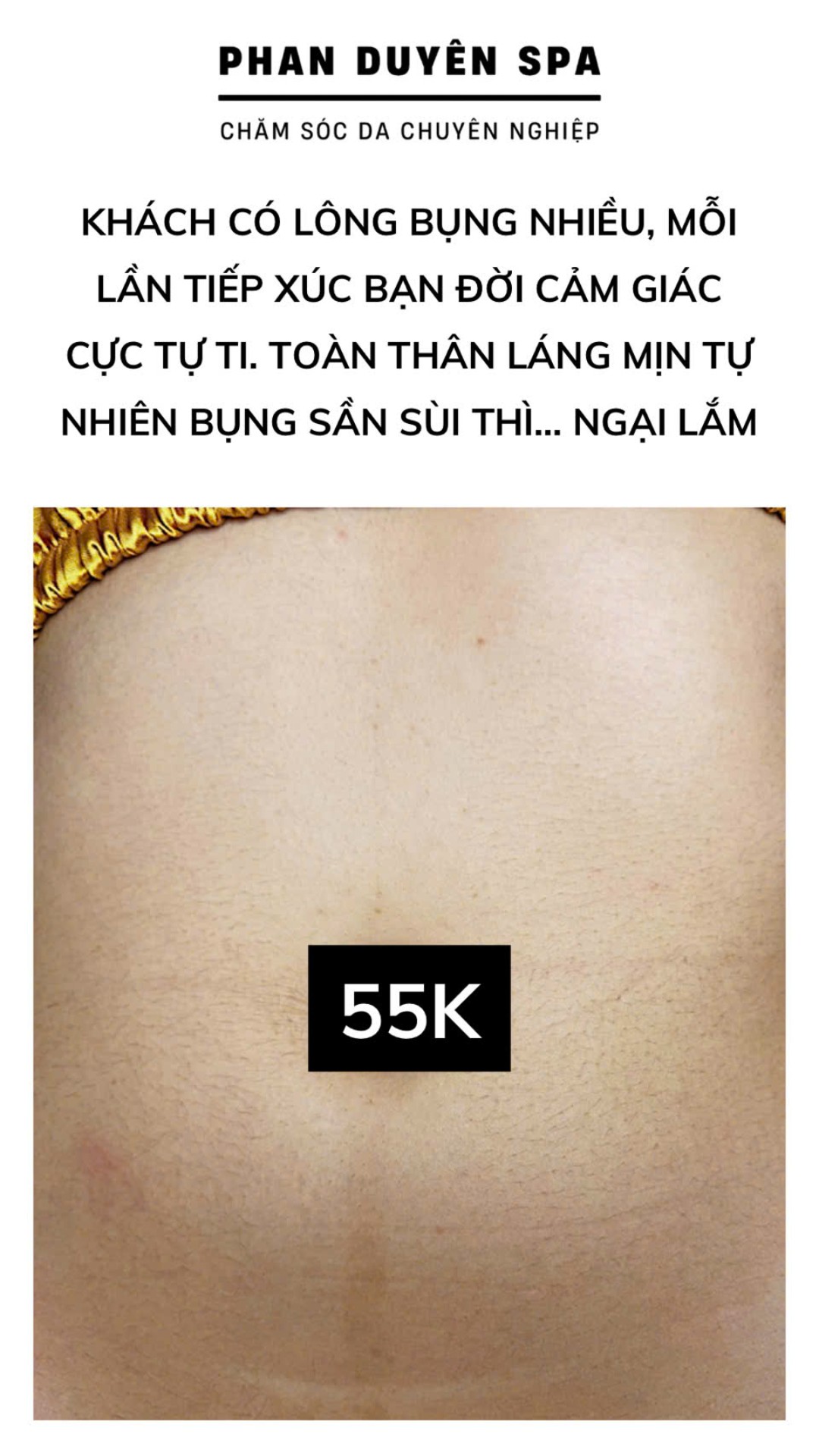 Triệt lông công nghệ Bình chánh Triệt lông công nghệ Bình chánh